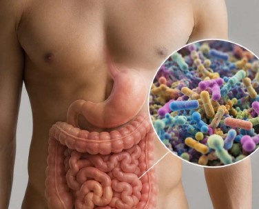Microbiota