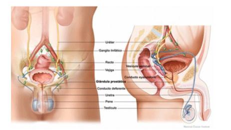 Cancer de prostata sintomas y signos iniciales